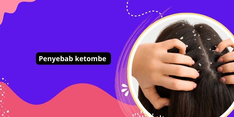 Bye-Bye Ketombe! Kenali 5 Penyebabnya Di Balik Penggunaan Produk Rambut